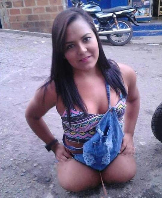 21P Amputee  Dreams
