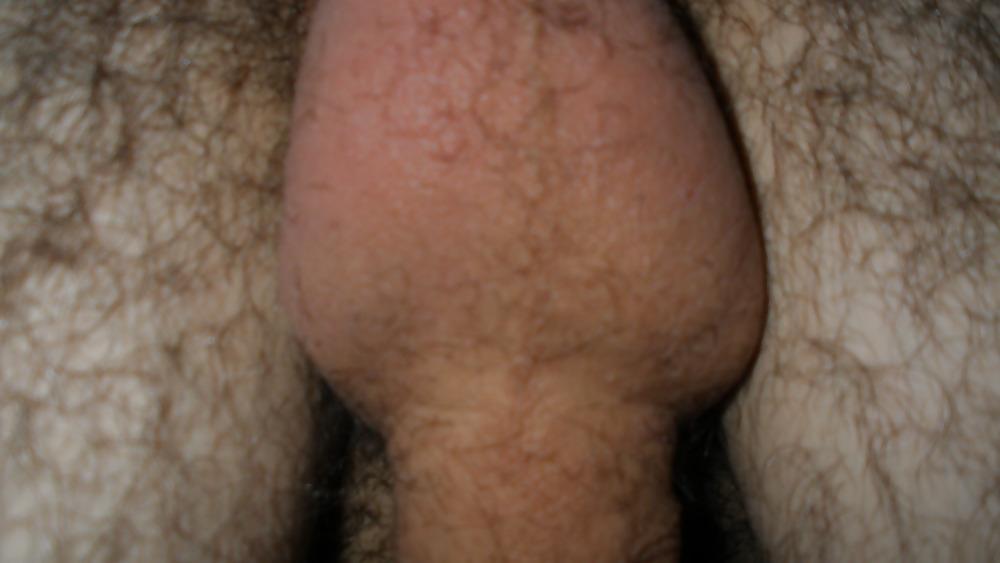 25P Me and My Cock