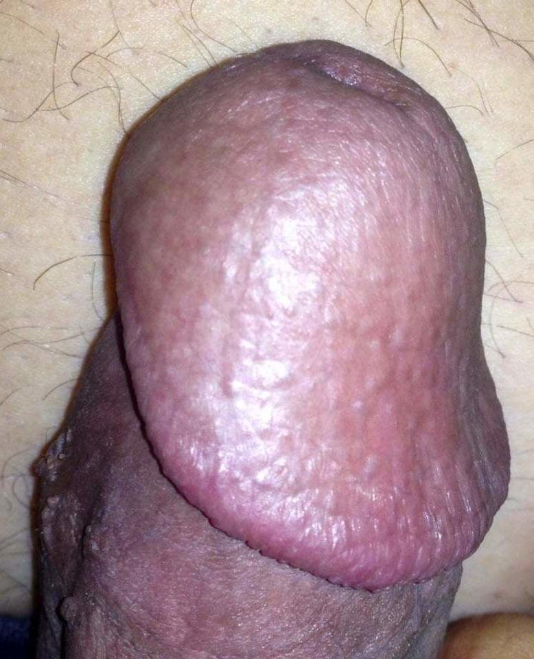 25P Public