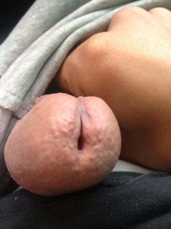 25P Public