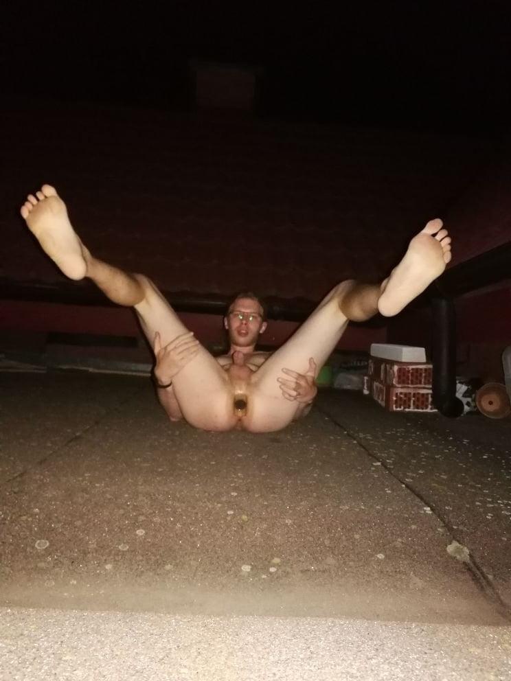 18P Anal