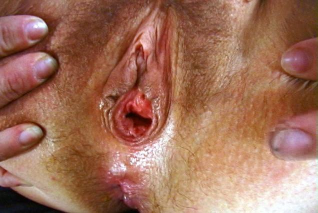 25P Amateur matures 1