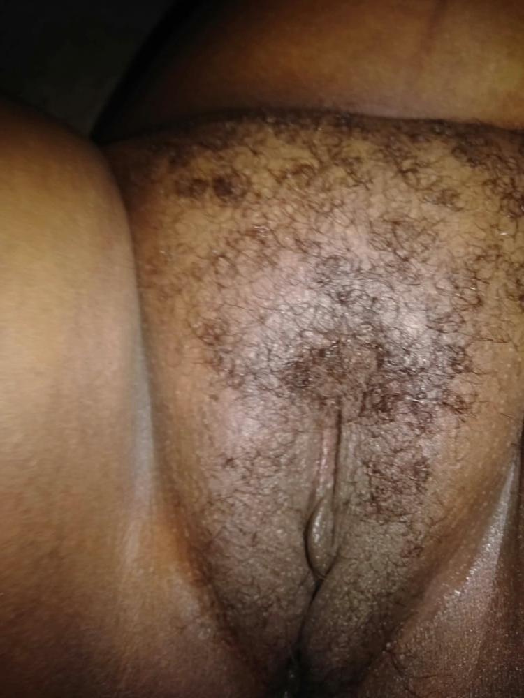 7P mature koap5