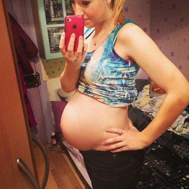 25P pregnant
