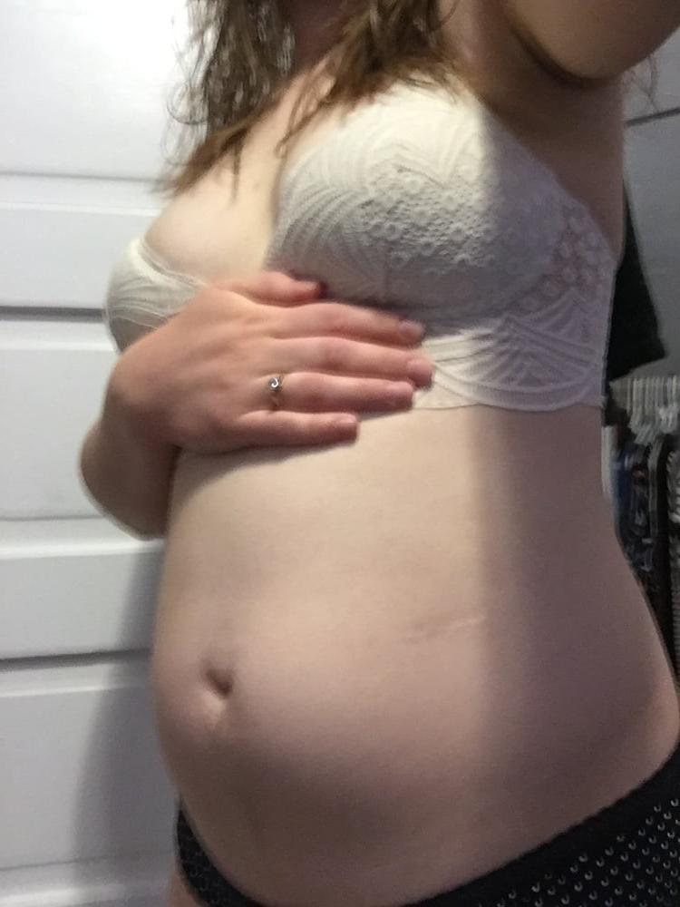 7P 20 Weeks Pregnant