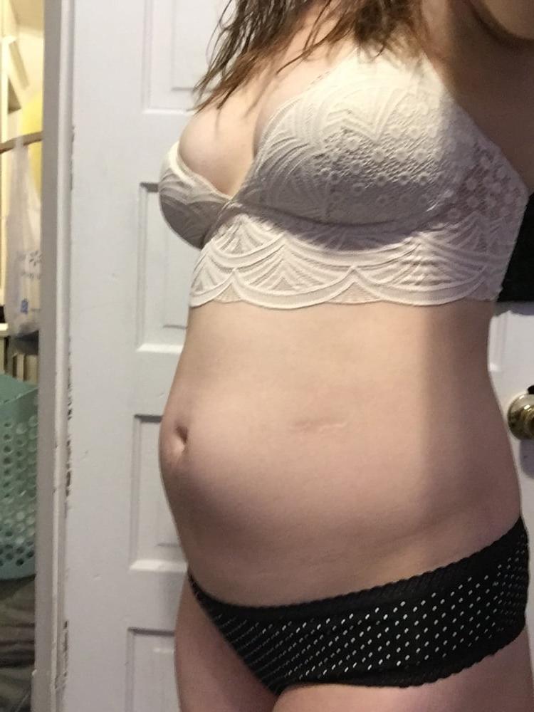 7P 20 Weeks Pregnant