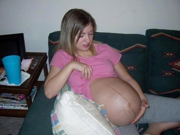 25P pregnant
