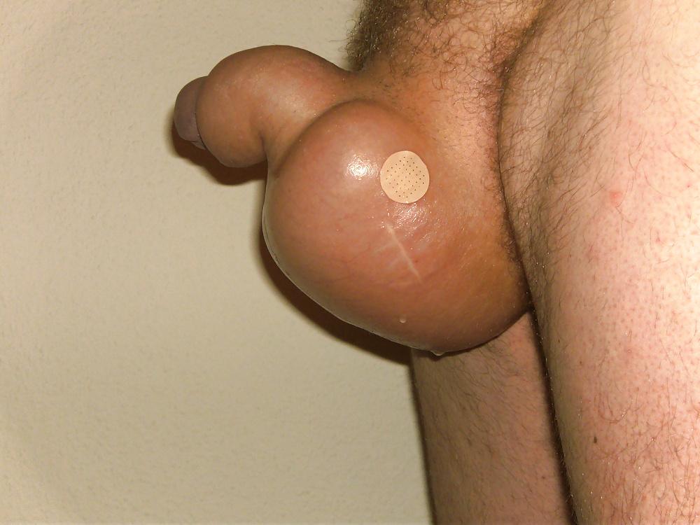8P Big balls 2
