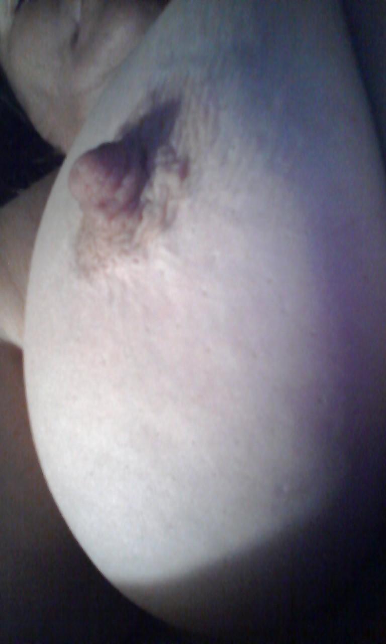 14P More of my wifes nipples
