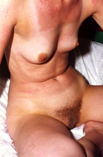 25P KEY - Tan Lines 0013 Hairy Bushes