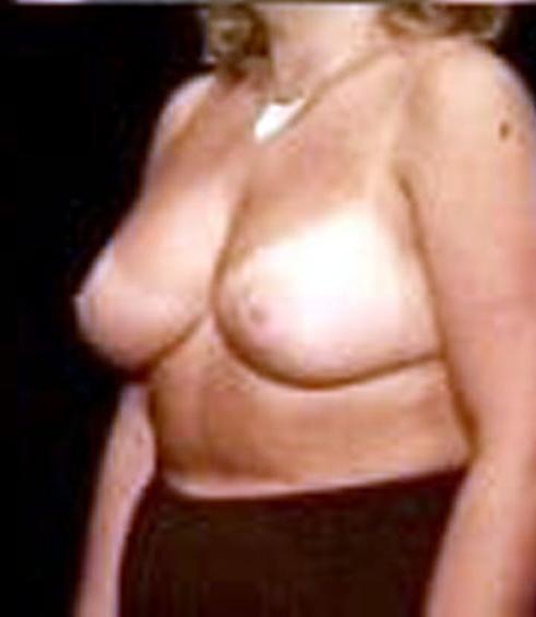 25P Tantalizing Tan Lines   56