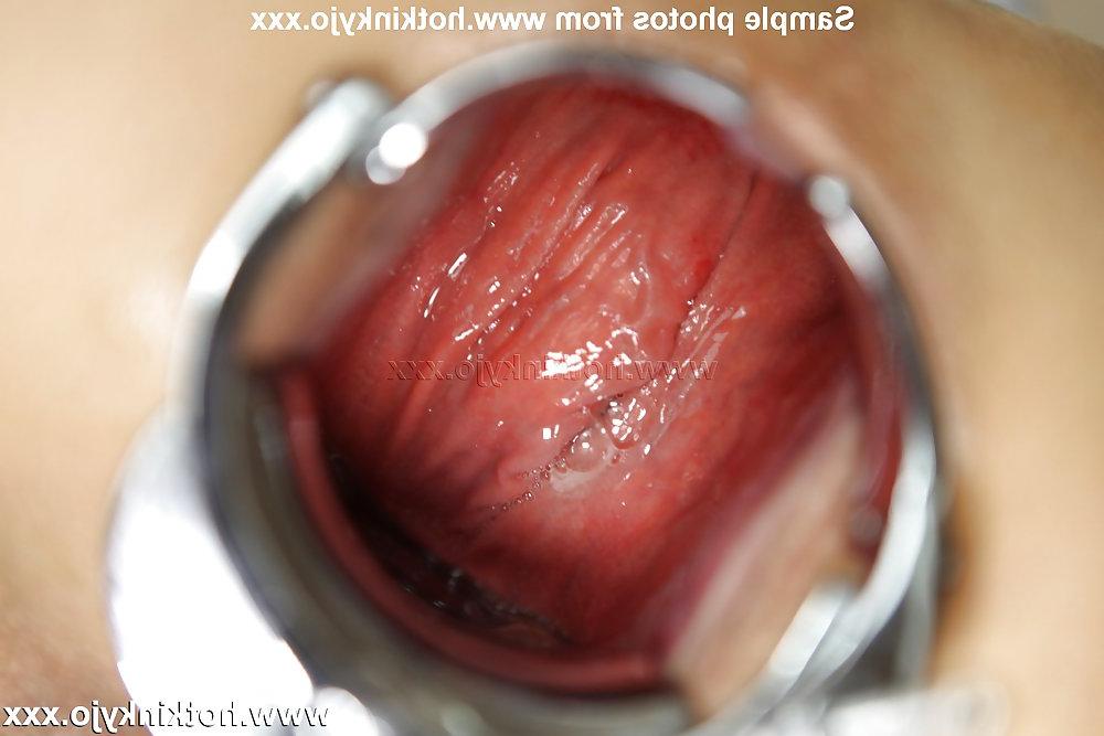 15P Hotkinkyjo XO speculum prolapse gape and deep fuck