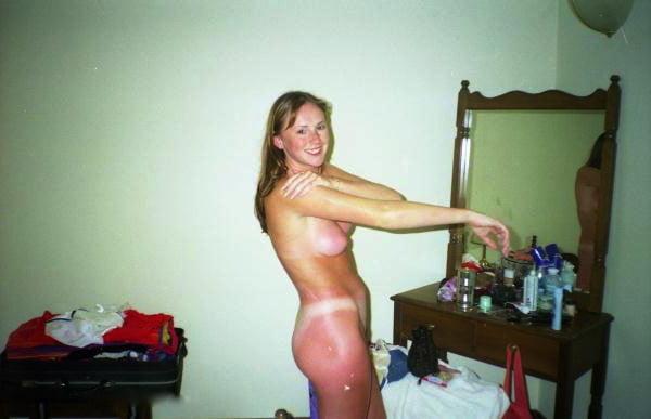 25P KEY - Tan Lines 0008 Sunburn