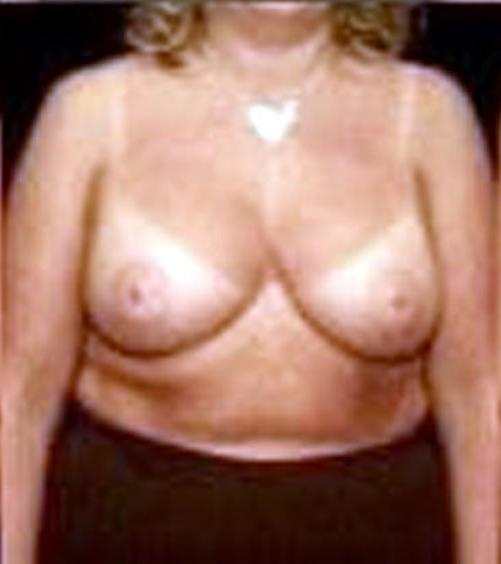 25P Tantalizing Tan Lines   51