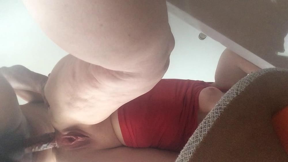 25P Anal