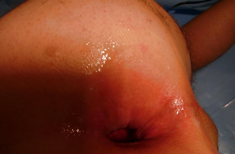 16P 2012 01 Giant bottle in asshole. Big gape, gaping assfist 2
