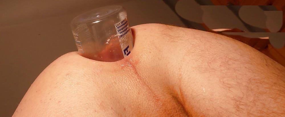 16P 2012 01 Giant bottle in asshole. Big gape, gaping assfist 2
