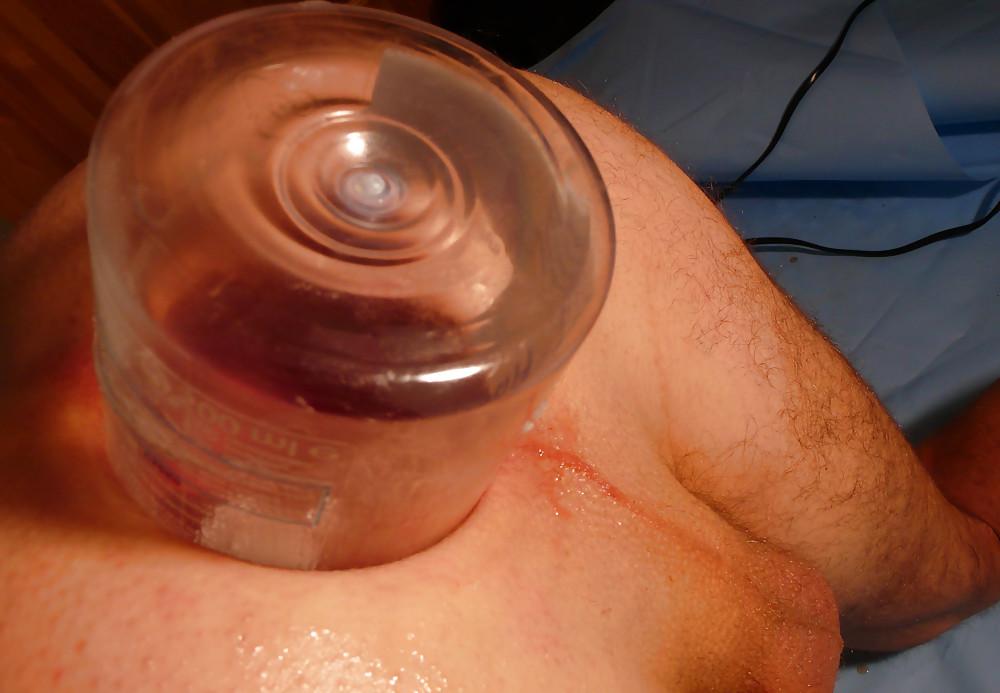 16P 2012 01 Giant bottle in asshole. Big gape, gaping assfist 2