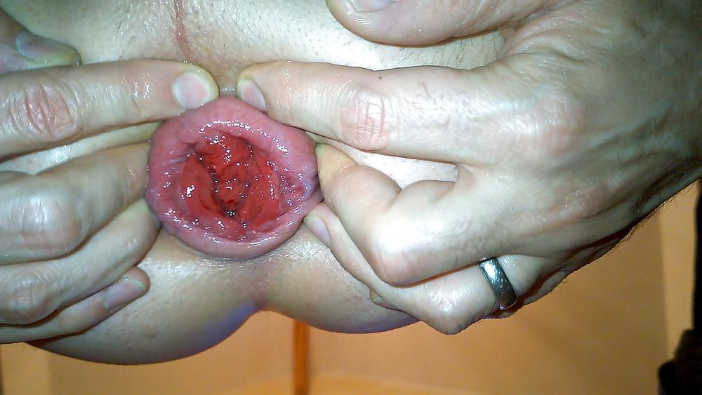 14P My new red dildo 7,8cm gape!