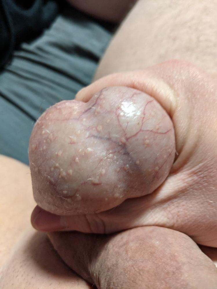 20P Ball Pictures #3 My balls hurting