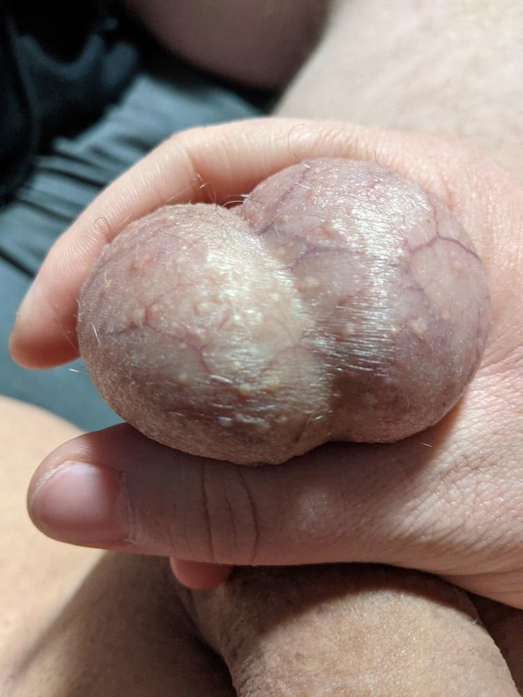 20P Ball Pictures #3 My balls hurting