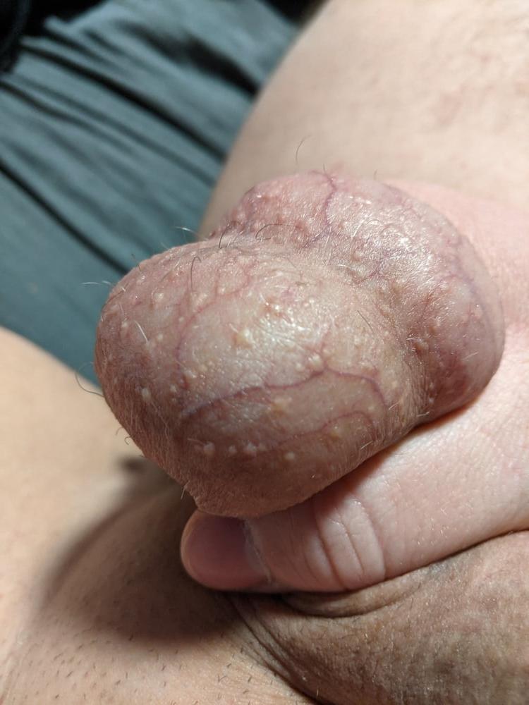 20P Ball Pictures #3 My balls hurting