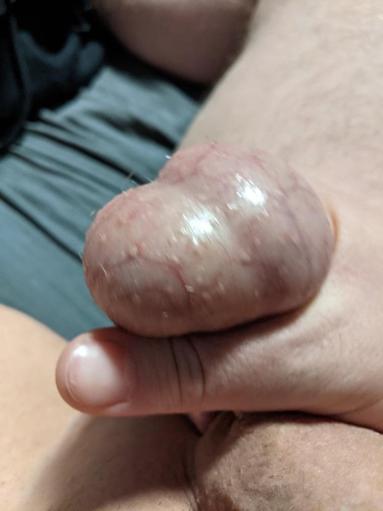 20P Ball Pictures #3 My balls hurting