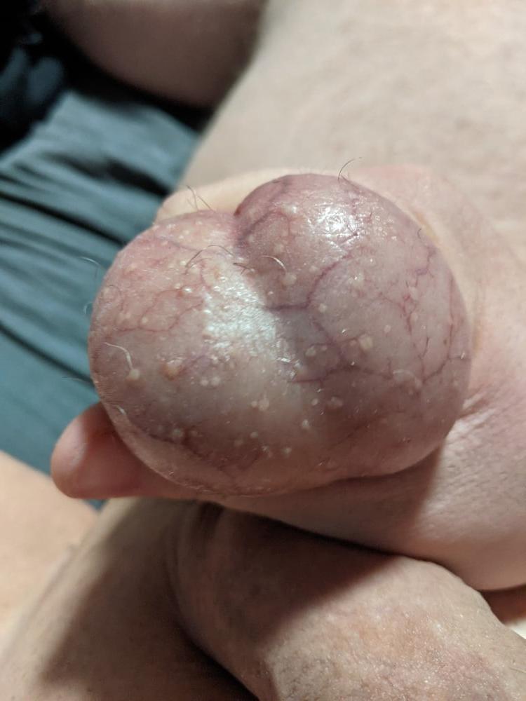 20P Ball Pictures #3 My balls hurting
