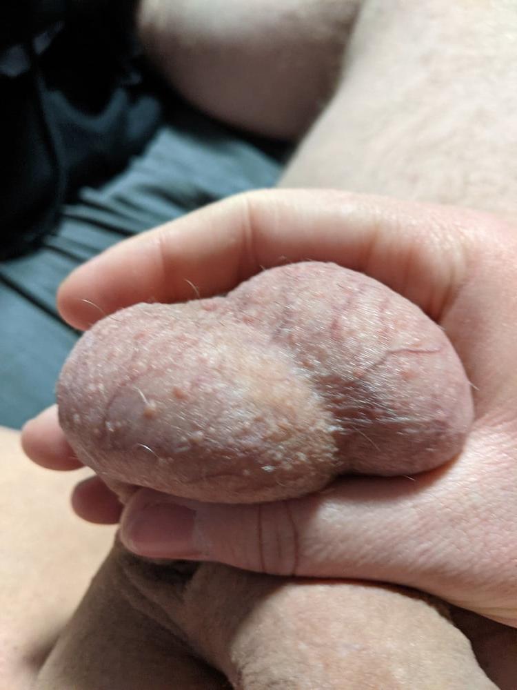 20P Ball Pictures #3 My balls hurting