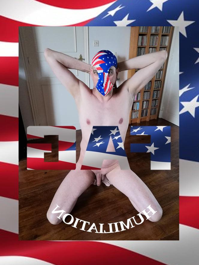 25P Faggot Exposure 2