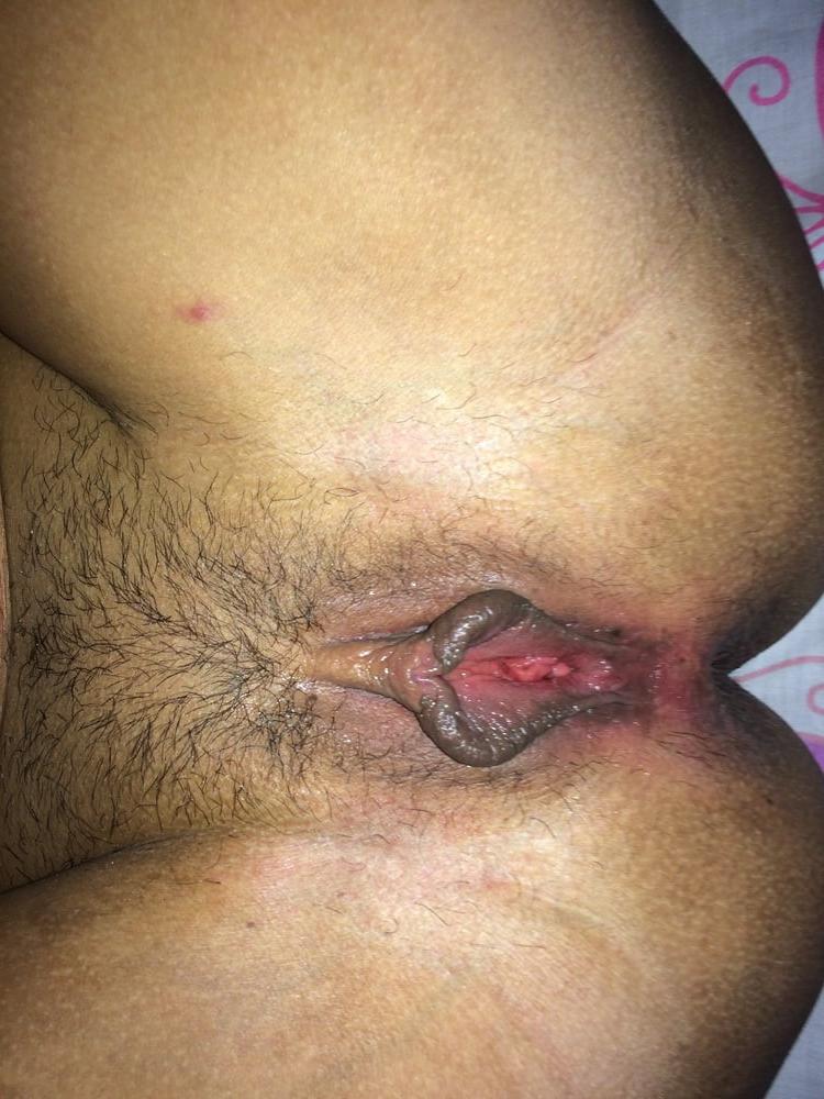 17P Anal fuck