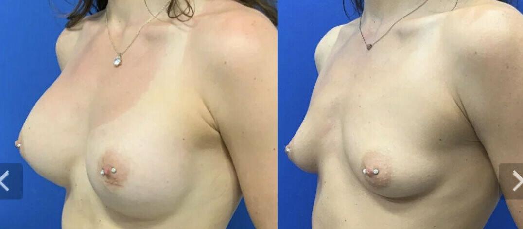 25P Taylor Stewart nude