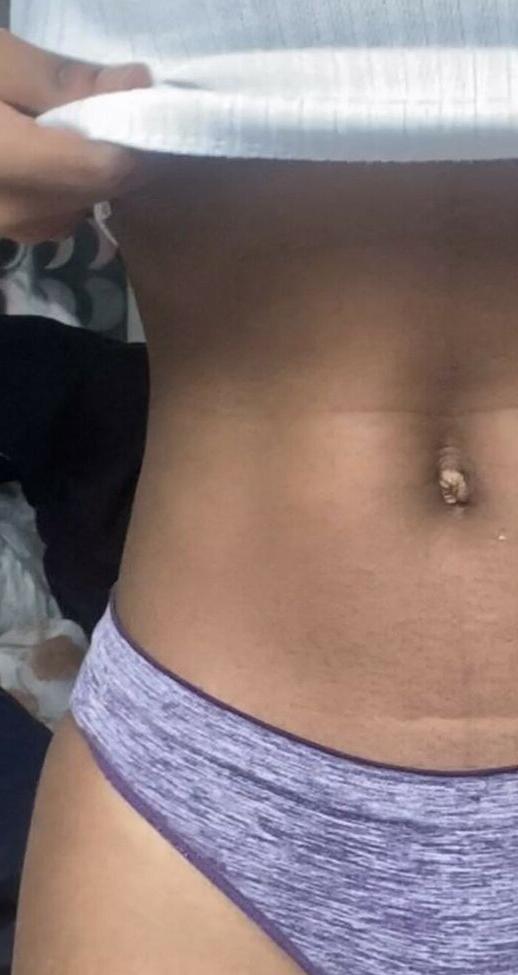25P Liltecette nude
