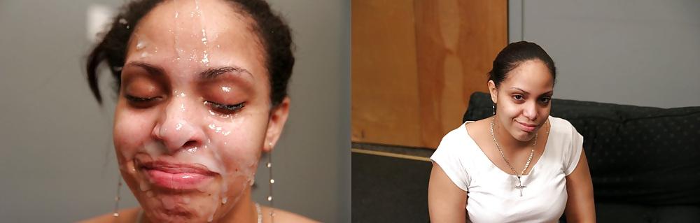 25P Before and After - Facials