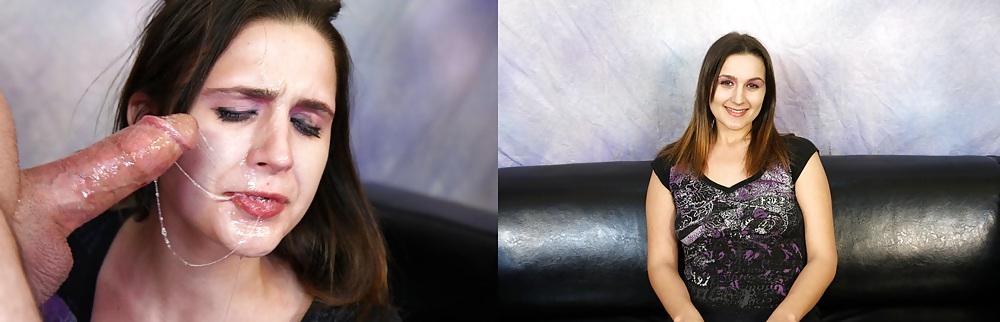 25P Before and After - Facials