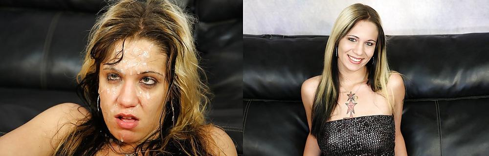 25P Before and After - Facials