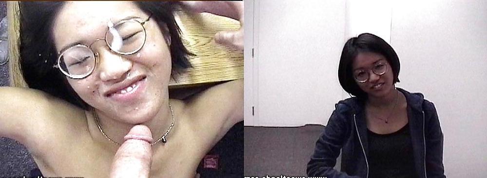 25P Before and After - Facials