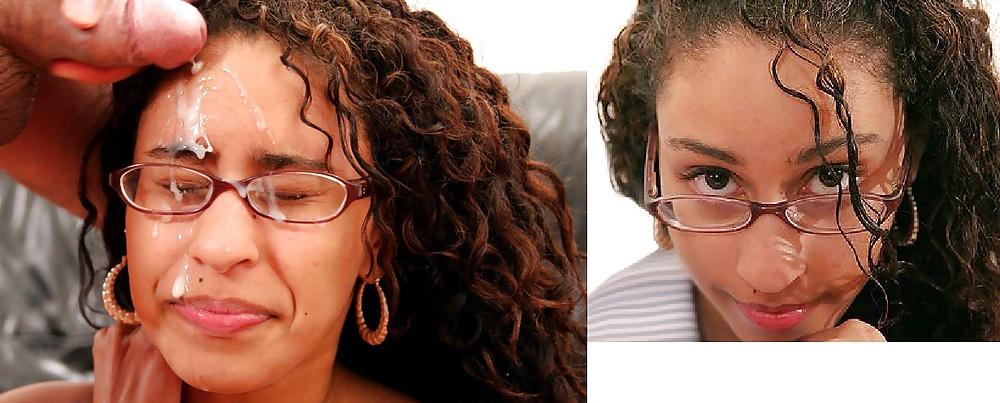 25P Before and After - Facials
