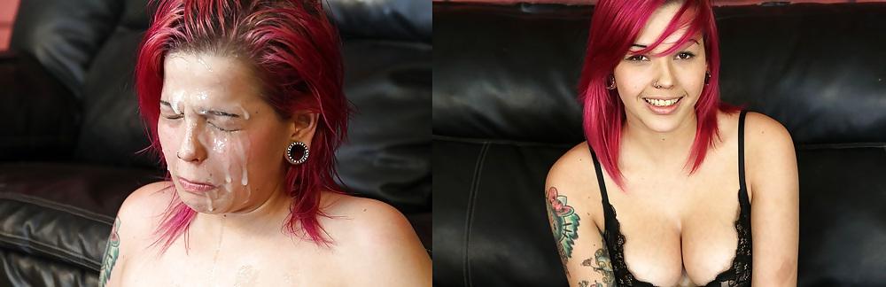 25P Before and After - Facials