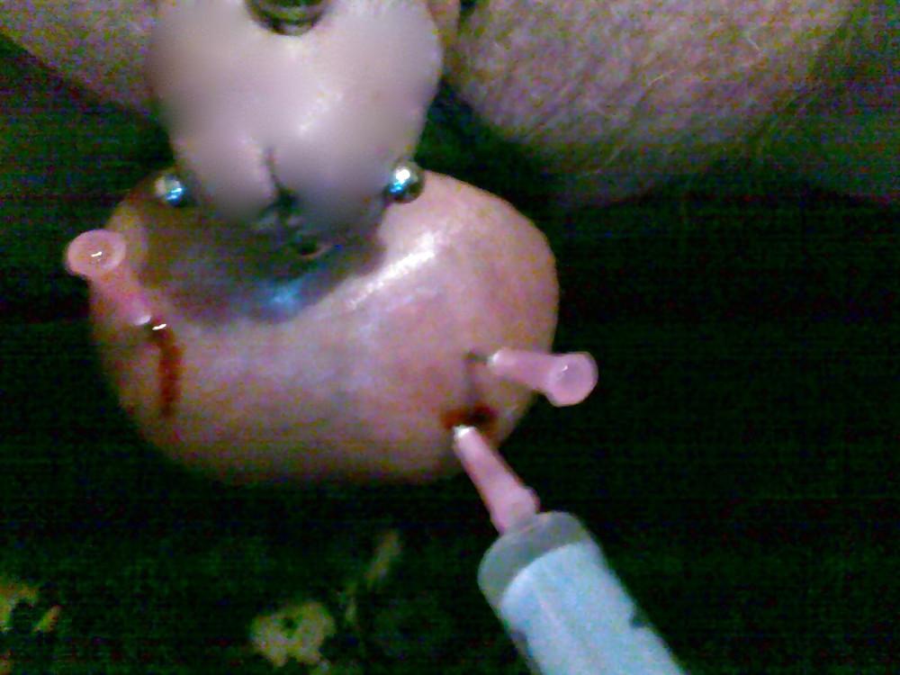 15P Balls Medical Play 3
