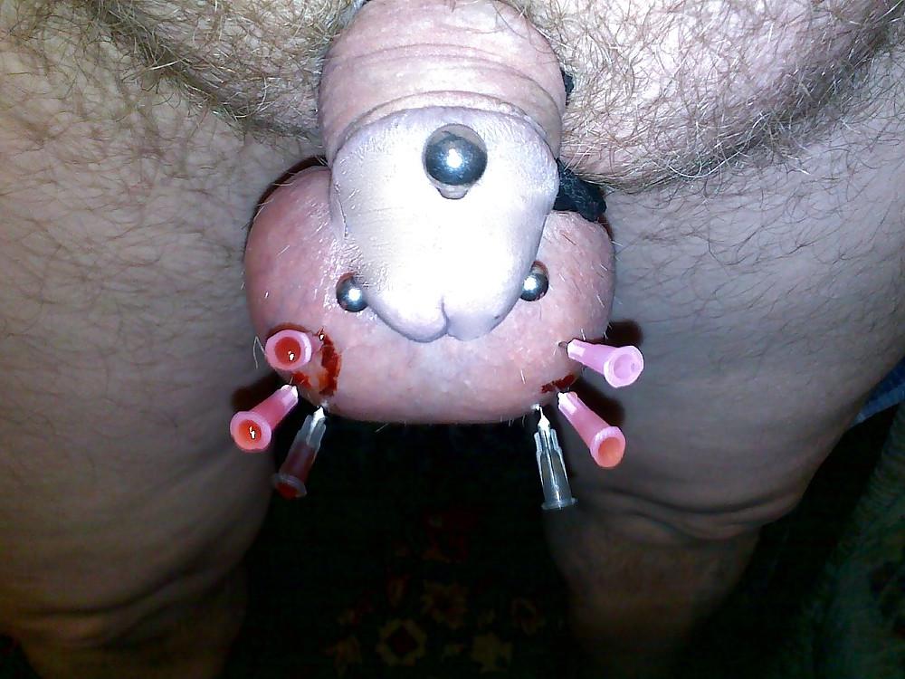 15P Balls Medical Play 3