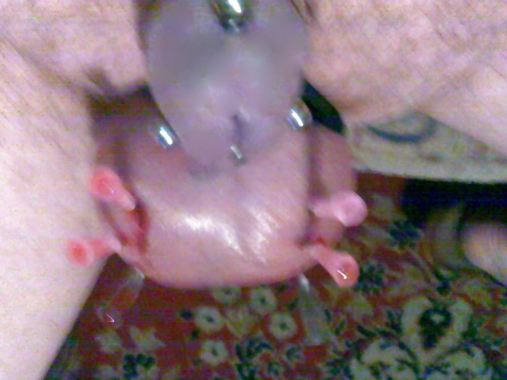 15P Balls Medical Play 3