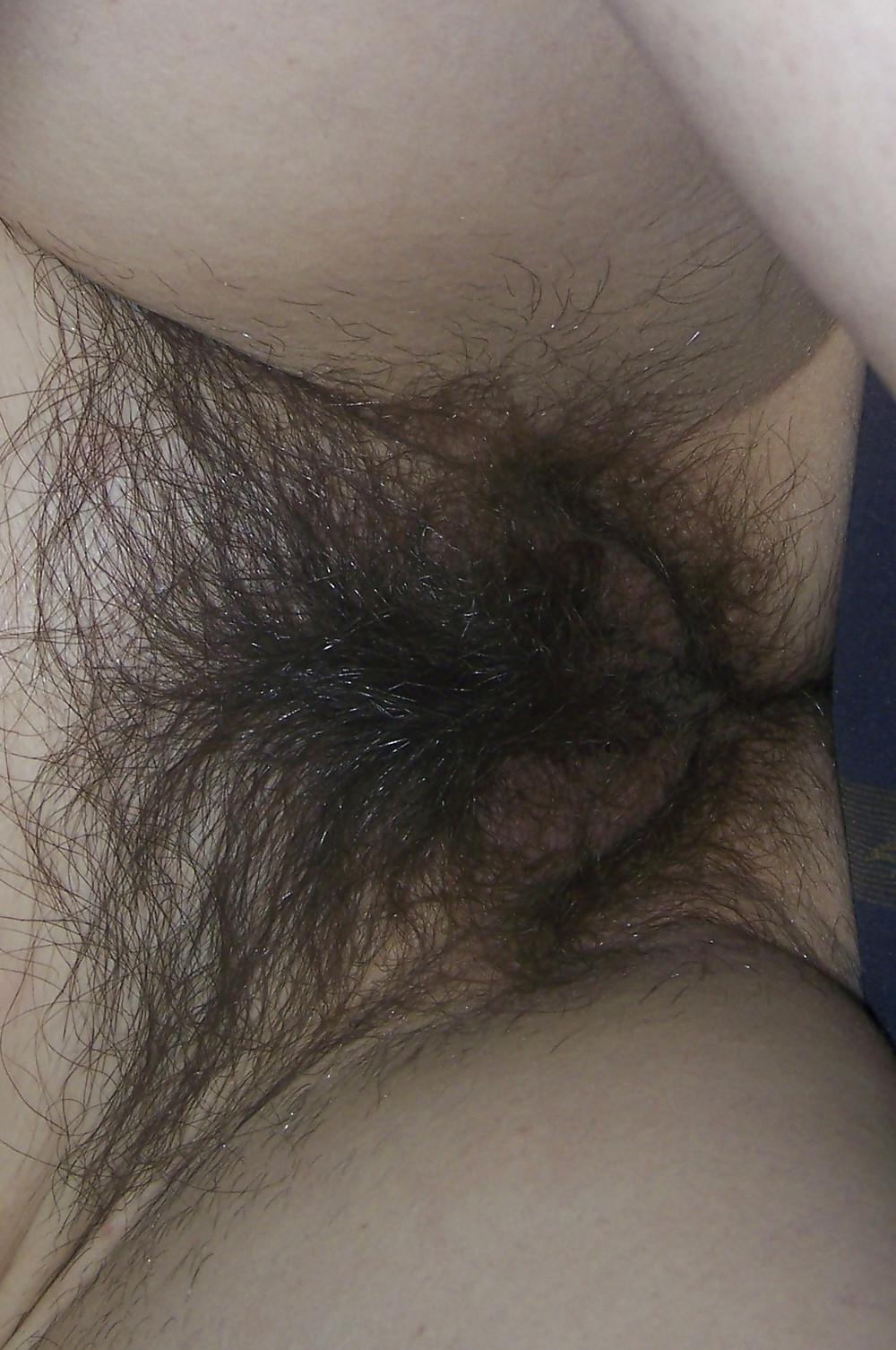 25P Hairy pussy exhibitionist