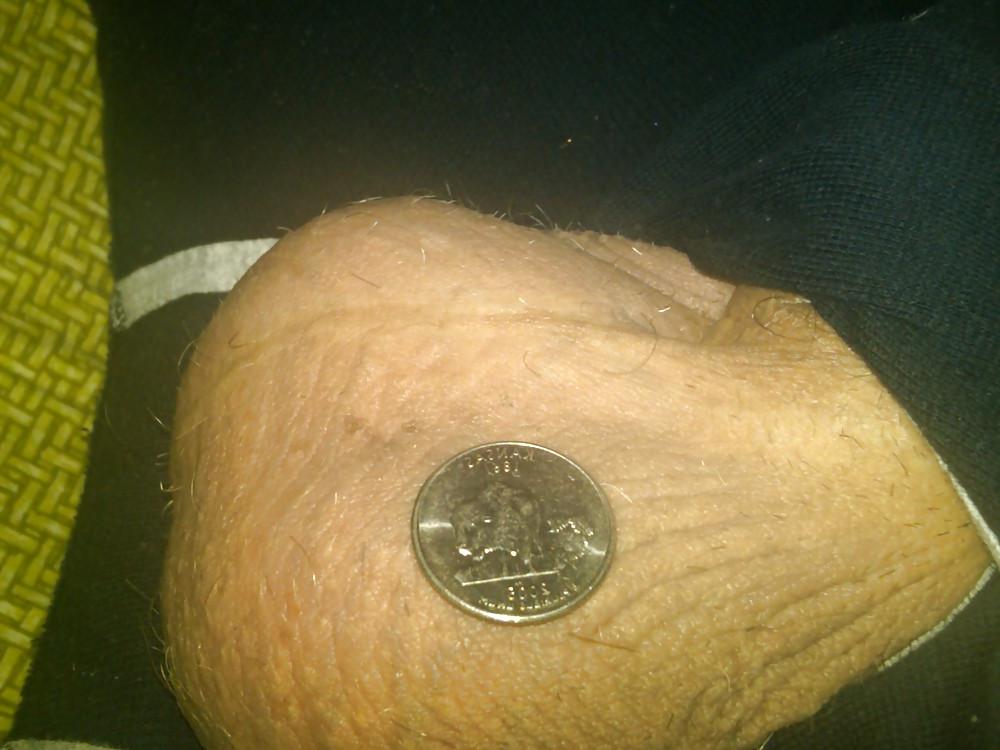 25P Huge Balls measured for size