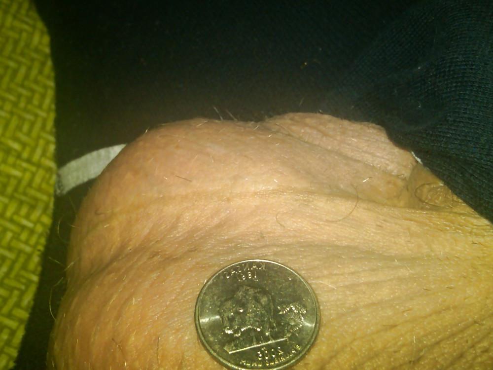 25P Huge Balls measured for size