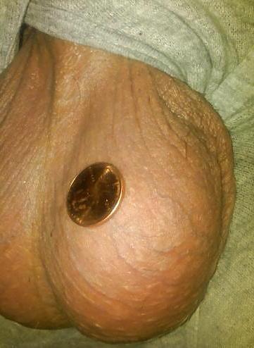 25P Huge Balls measured for size