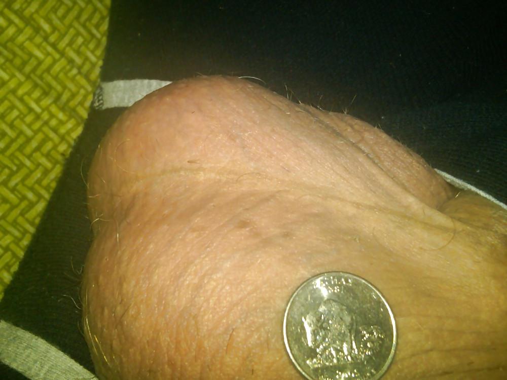 25P Huge Balls measured for size