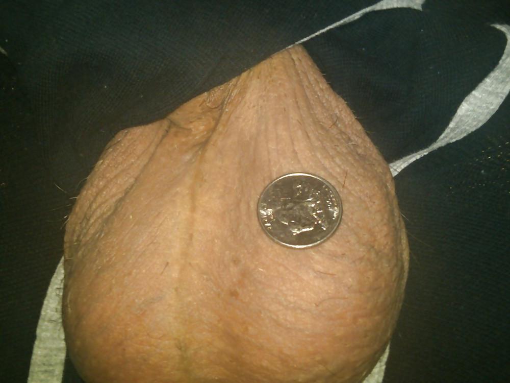 25P Huge Balls measured for size