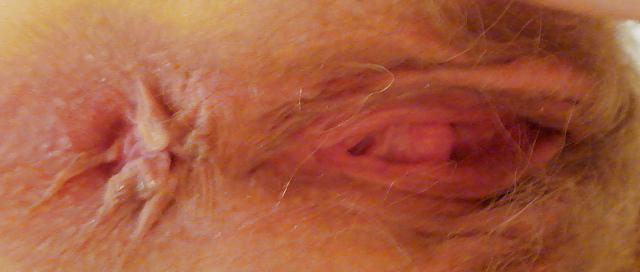 25P Yummy Big Hairy Pussy and Long Nipples 3