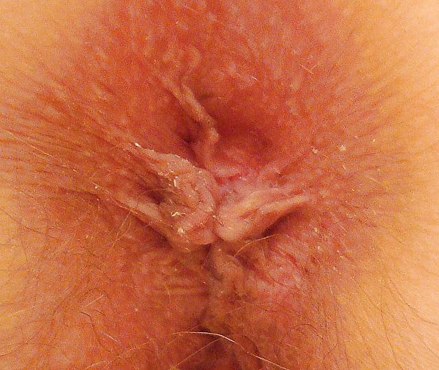 25P Yummy Big Hairy Pussy and Long Nipples 3
